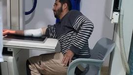 الصحفي محمد أبو ثابت عقب اصابته برصاصة مطاطية باليد خلال تغطيته مواجهات قرية بيت دجن شرق نابلس