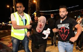 إصابات الأقصى
