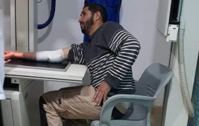 الصحفي محمد أبو ثابت عقب اصابته برصاصة مطاطية باليد خلال تغطيته مواجهات قرية بيت دجن شرق نابلس